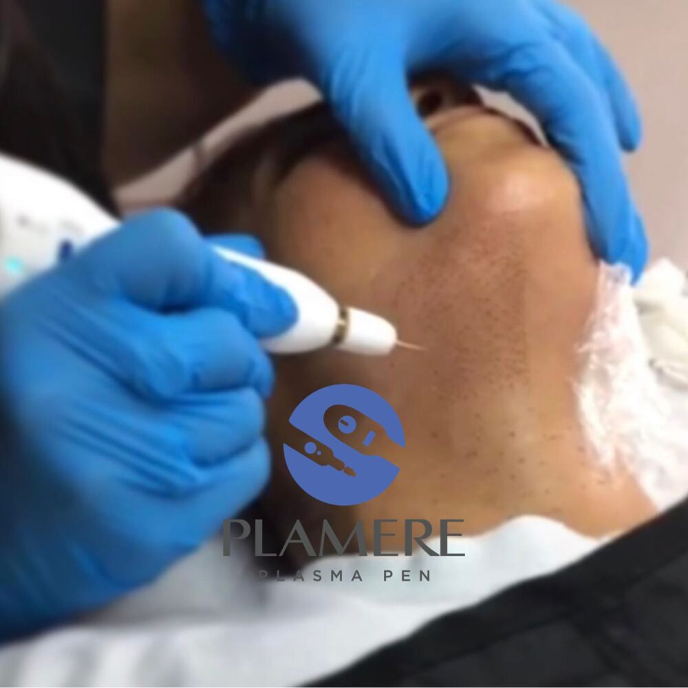 WhatsApp Image 2022-11-11 at 10.20.54