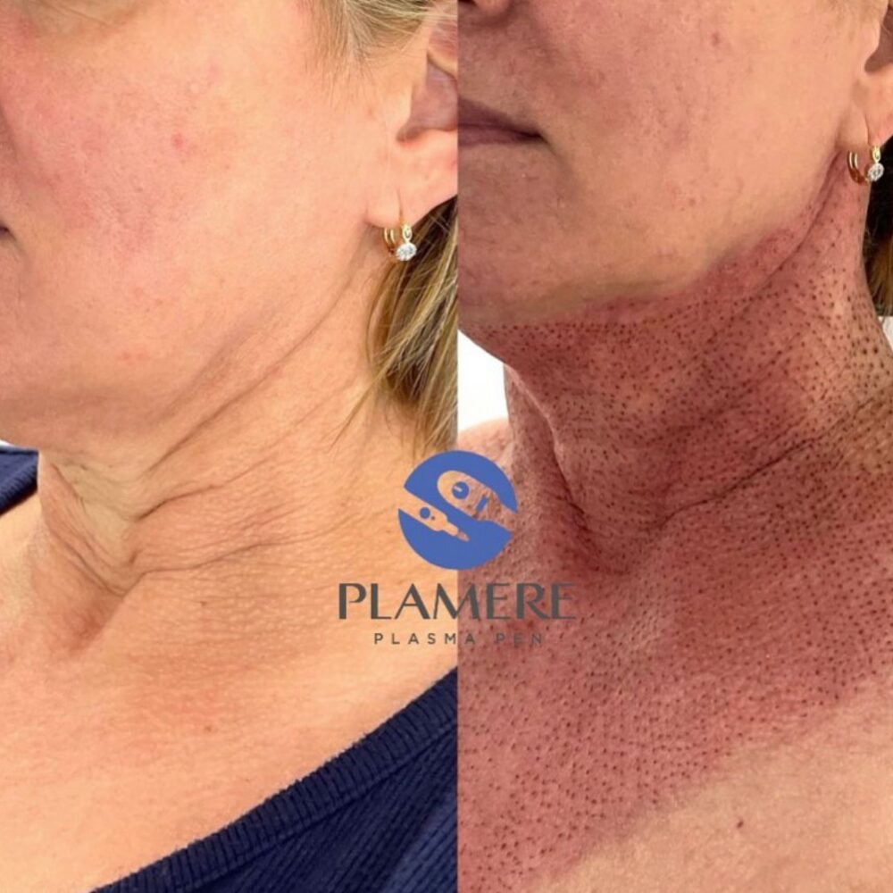 WhatsApp Image 2022-11-11 at 10.20.56