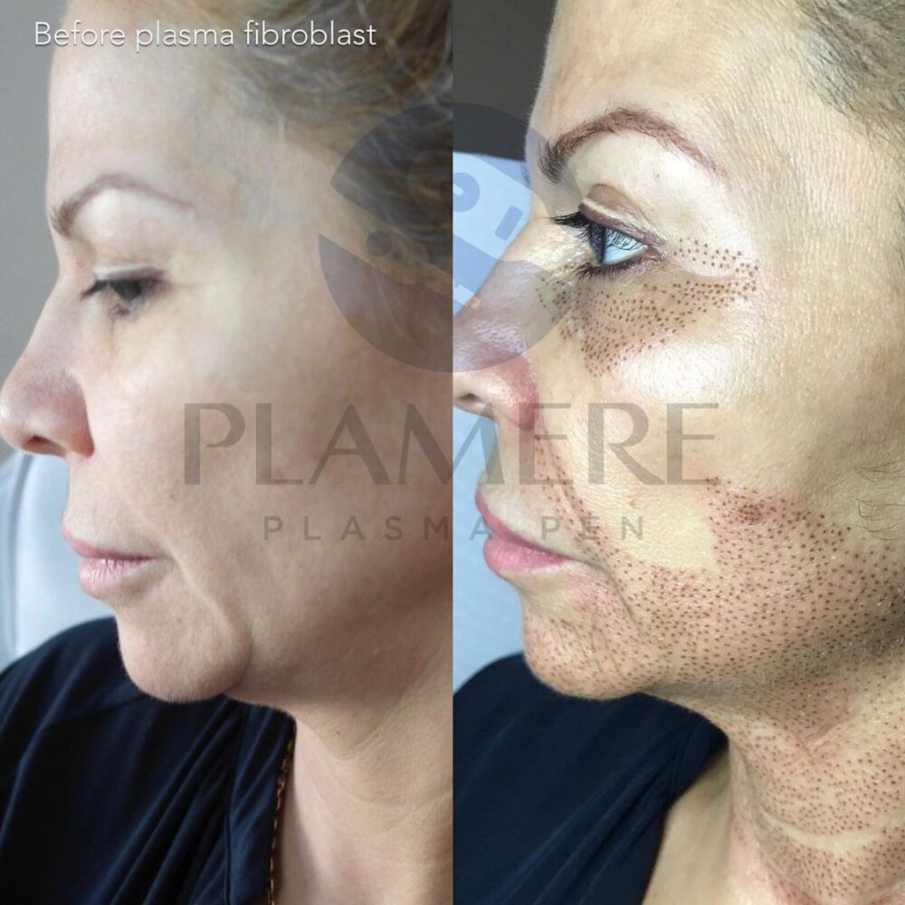 WhatsApp Image 2022-11-11 at 10.20.57 (1)