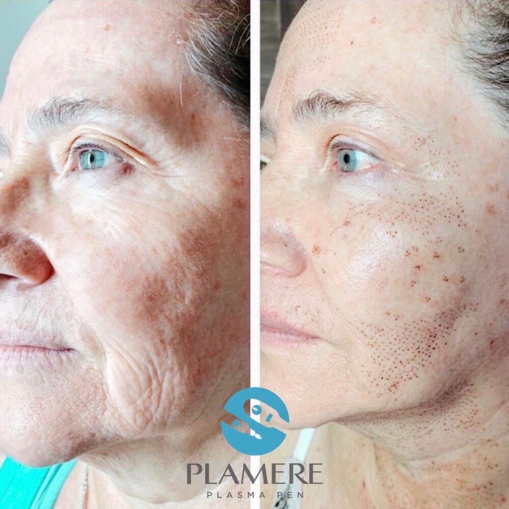 WhatsApp Image 2022-11-11 at 10.20.57